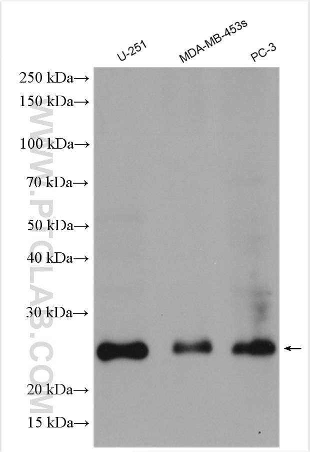 WB analysis using 25465-1-AP