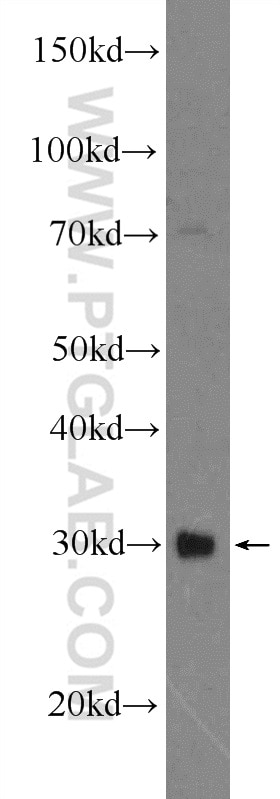 Western Blot (WB) analysis of A549 cells using TWIST1-specific Polyclonal antibody (25465-1-AP)