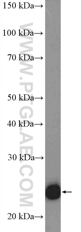 TWIST1-specific Polyclonal antibody