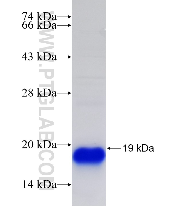 TWIST1 fusion protein Ag21924 SDS-PAGE