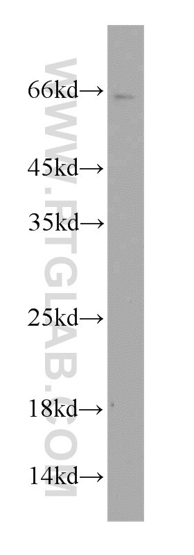 Western Blot (WB) analysis of mouse liver tissue using TWIST2 Polyclonal antibody (11752-1-AP)