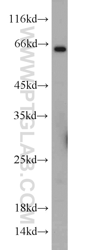 Western Blot (WB) analysis of MCF-7 cells using TWIST2 Polyclonal antibody (11752-1-AP)