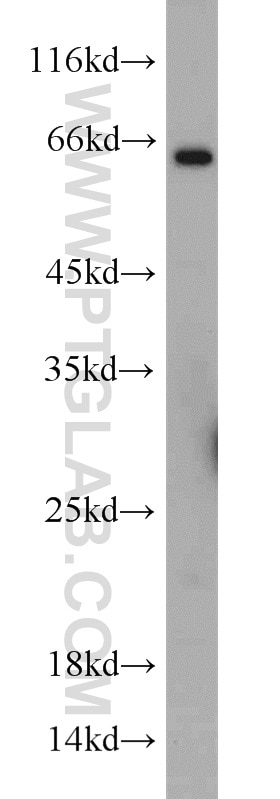 WB analysis of MCF-7 using 11752-1-AP