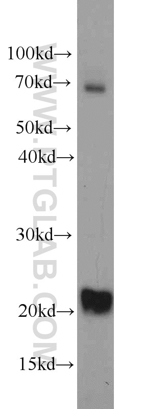 Western Blot (WB) analysis of NIH/3T3 cells using TWIST2 Polyclonal antibody (11752-1-AP)