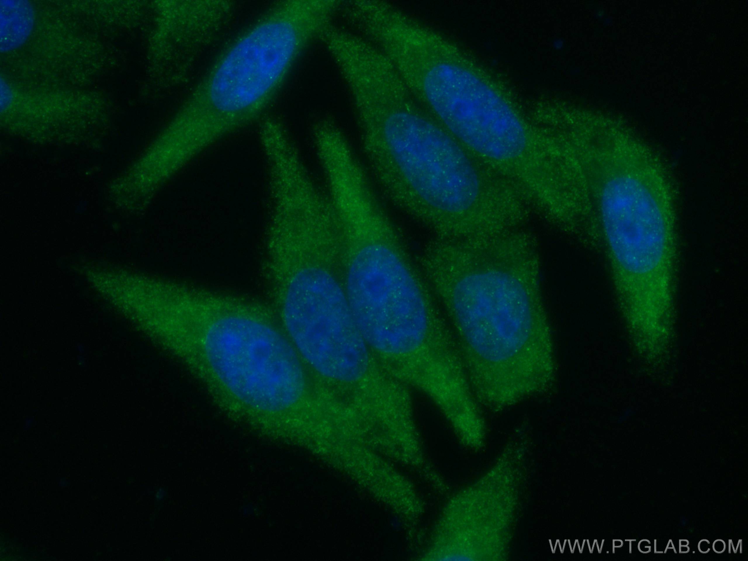 Immunofluorescence (IF) / fluorescent staining of HepG2 cells using TWIST2 Monoclonal antibody (66544-1-Ig)