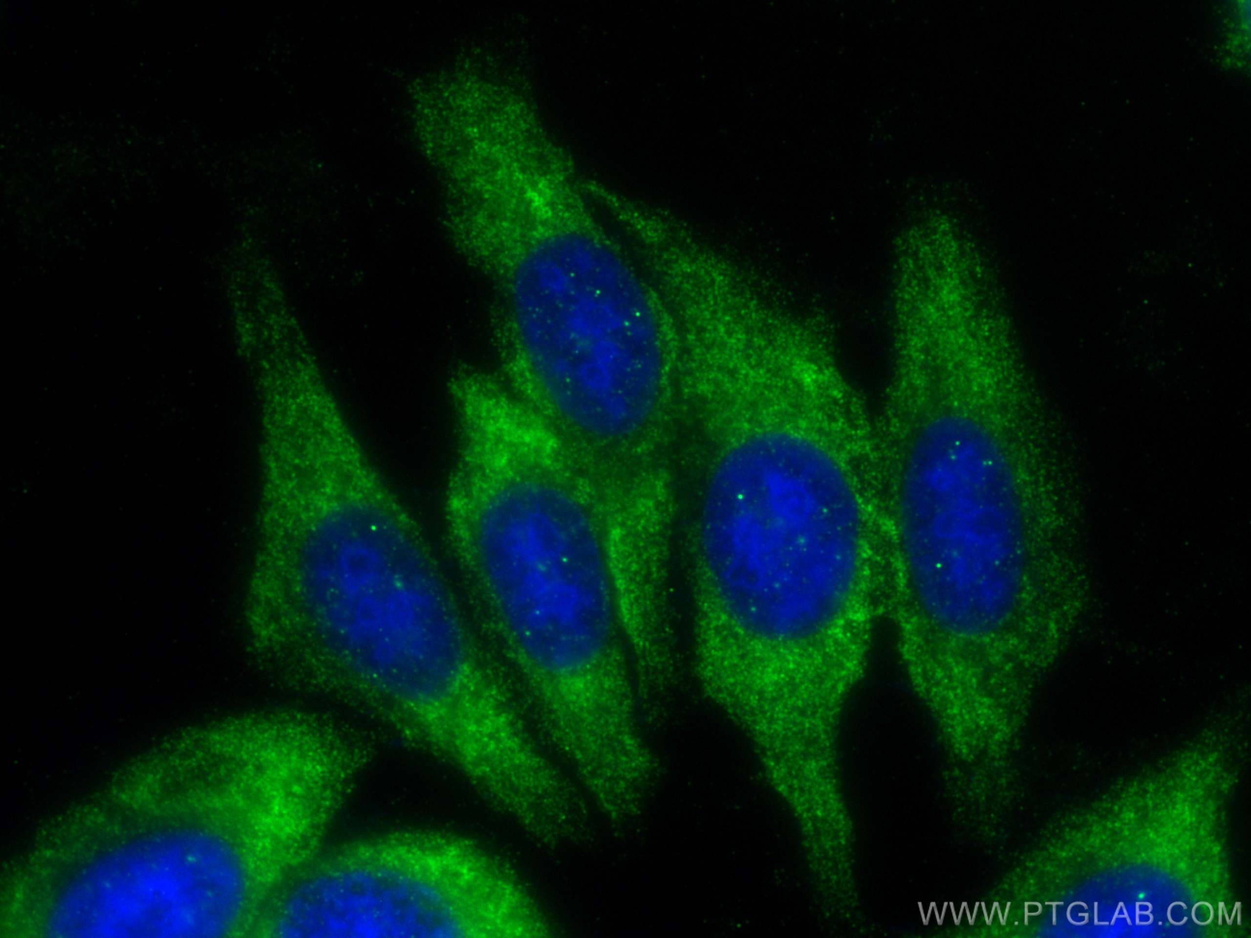 Immunofluorescence (IF) / fluorescent staining of HepG2 cells using TWIST2 Monoclonal antibody (66544-1-Ig)