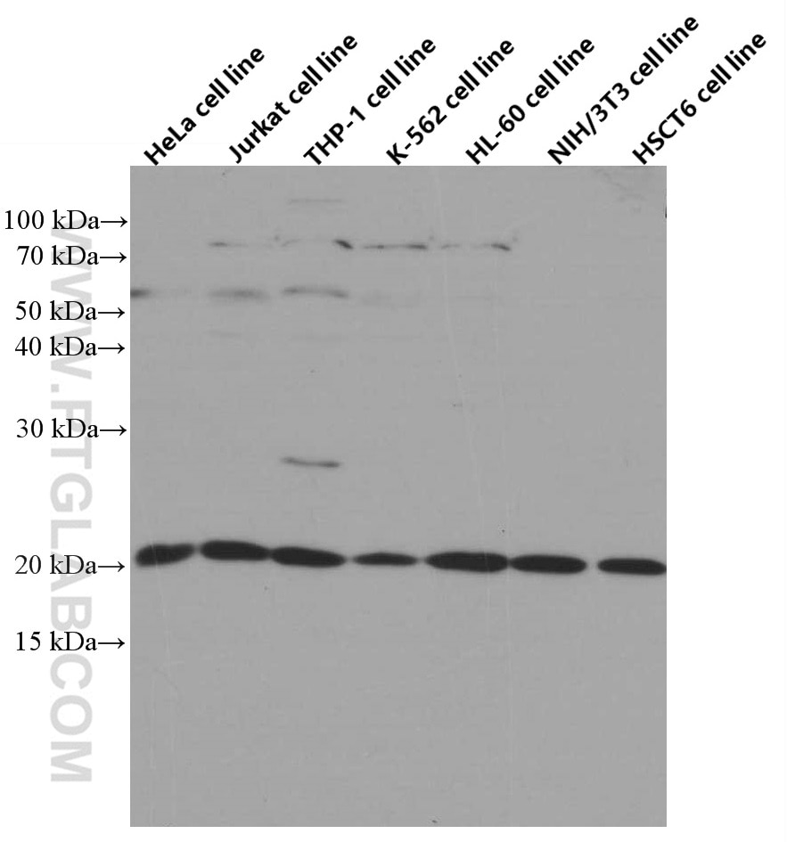 Western Blot (WB) analysis of various lysates using TWIST2 Monoclonal antibody (66544-1-Ig)