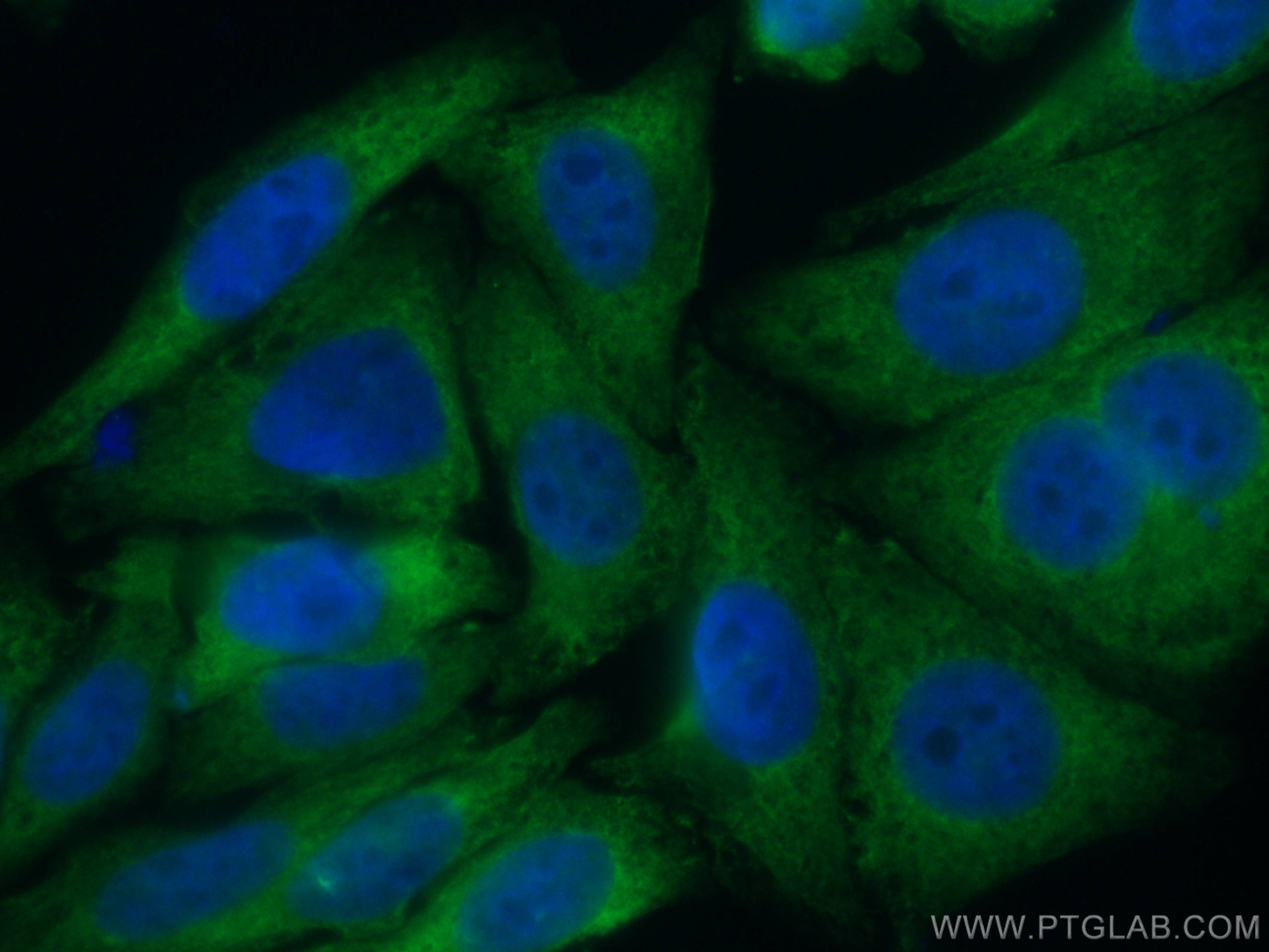 Immunofluorescence (IF) / fluorescent staining of HepG2 cells using CoraLite® Plus 488-conjugated TWIST2 Monoclonal an (CL488-66544)