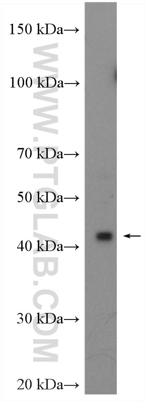 WB analysis of HeLa using 22784-1-AP