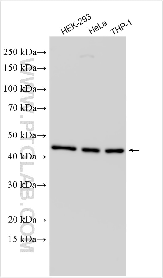 Western Blot (WB) analysis of various lysates using TWISTNB Polyclonal antibody (22784-1-AP)