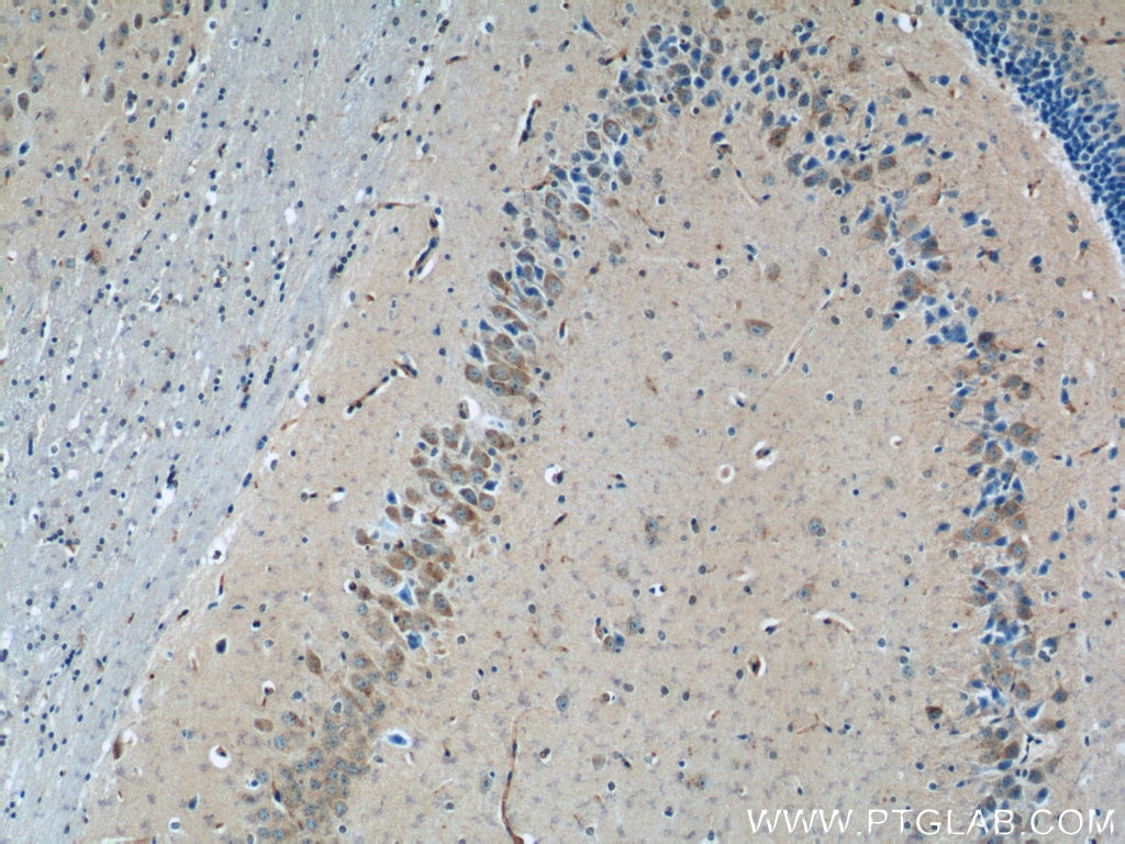 Immunohistochemistry (IHC) staining of mouse brain tissue using TWSG1 Polyclonal antibody (12327-1-AP)