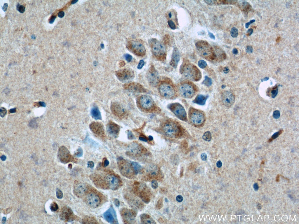 Immunohistochemistry (IHC) staining of mouse brain tissue using TWSG1 Polyclonal antibody (12327-1-AP)