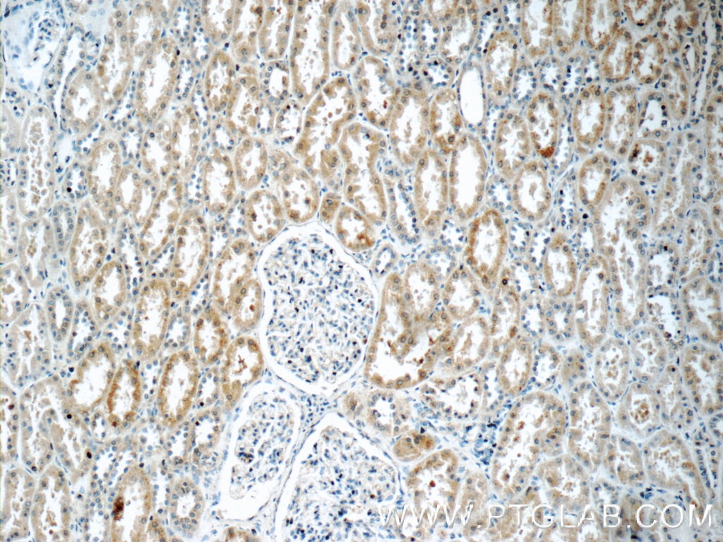 Immunohistochemistry (IHC) staining of human kidney tissue using TWSG1 Polyclonal antibody (12327-1-AP)