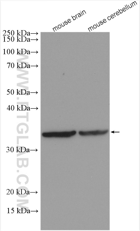 Western Blot (WB) analysis of various lysates using TWSG1 Polyclonal antibody (12327-1-AP)