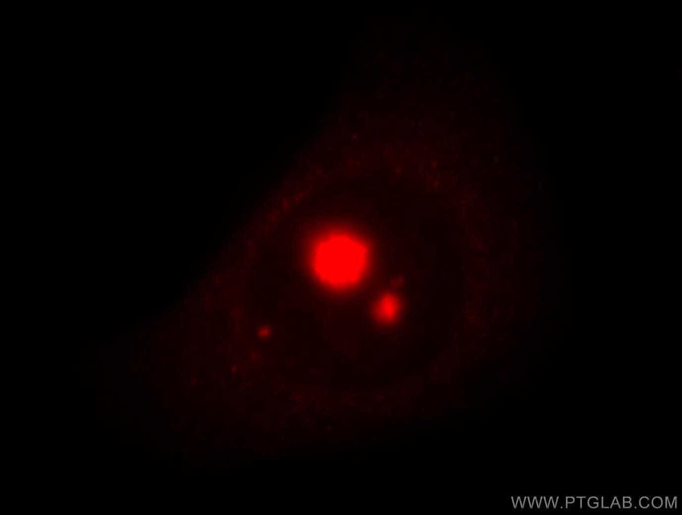 Immunofluorescence (IF) / fluorescent staining of HeLa cells using TXK Polyclonal antibody (18981-1-AP)