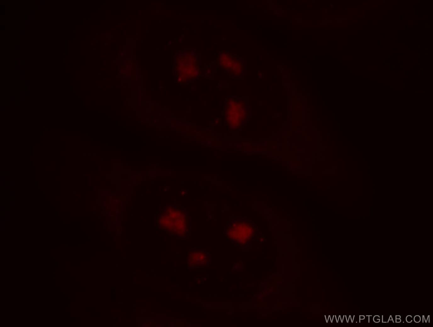 Immunofluorescence (IF) / fluorescent staining of HepG2 cells using TXK Polyclonal antibody (18981-1-AP)