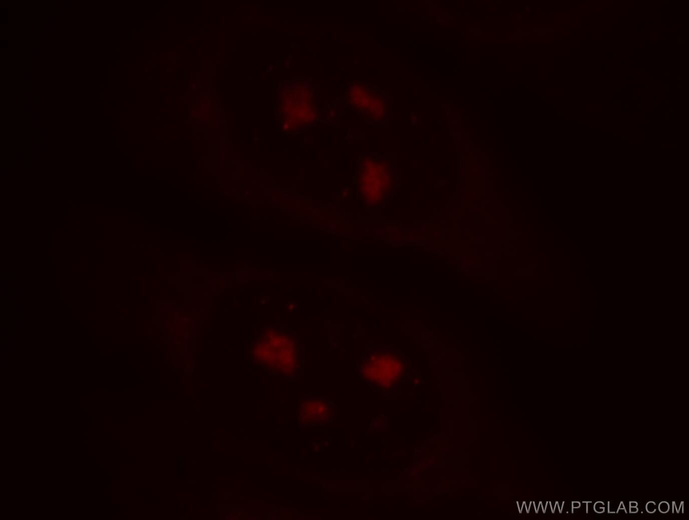 Immunofluorescence (IF) / fluorescent staining of HepG2 cells using TXK Polyclonal antibody (18981-1-AP)