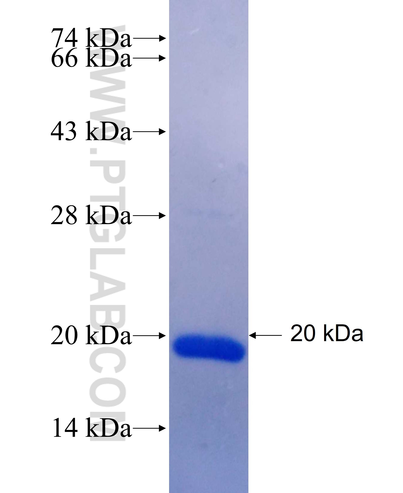 TXLNA fusion protein Ag25465 SDS-PAGE