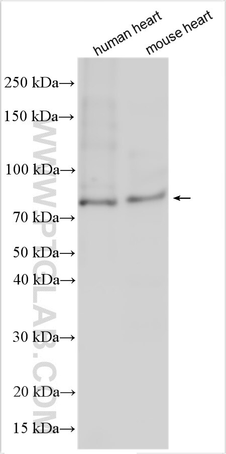 WB analysis using 22090-1-AP (same clone as 22090-1-PBS) Western Blot (WB) analysis of various lysates using TXLNB Polyclonal antibody (22090-1-AP)