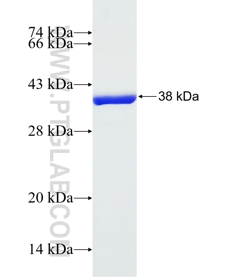 TXN fusion protein Ag6989 SDS-PAGE