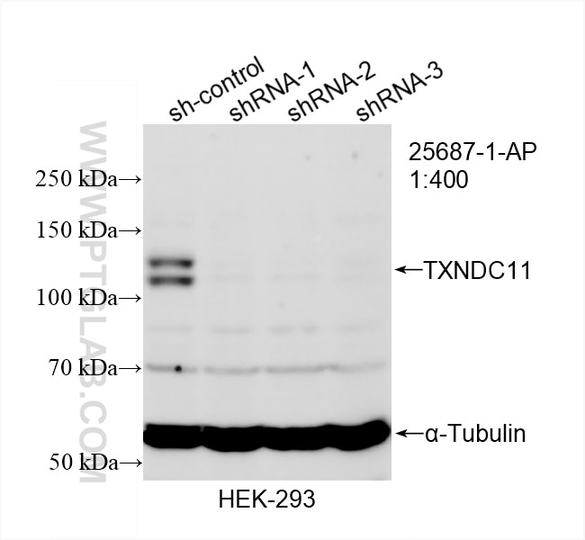 Western Blot (WB) analysis of HEK-293 cells using TXNDC11 Polyclonal antibody (25687-1-AP)