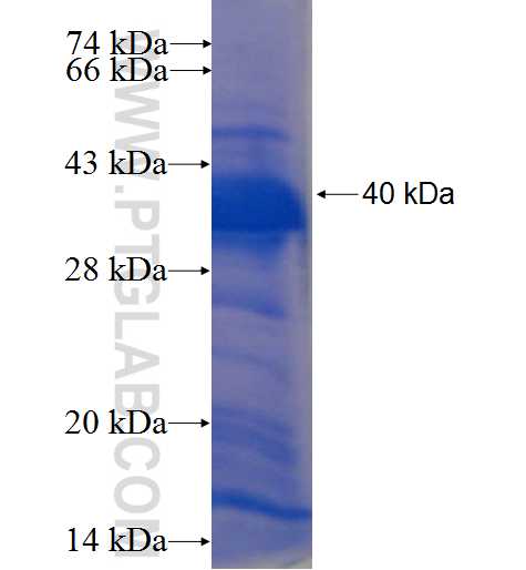 TXNDC11 fusion protein Ag22618 SDS-PAGE