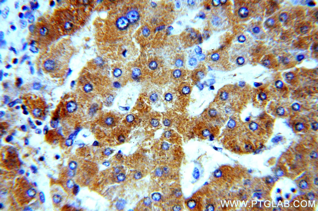Immunohistochemistry (IHC) staining of human hepatocirrhosis tissue using ERp19 Polyclonal antibody (20181-1-AP)