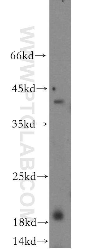 Western Blot (WB) analysis of human brain tissue using ERp19 Polyclonal antibody (20181-1-AP)