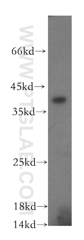 Western Blot (WB) analysis of mouse kidney tissue using ERp19 Polyclonal antibody (20181-1-AP)