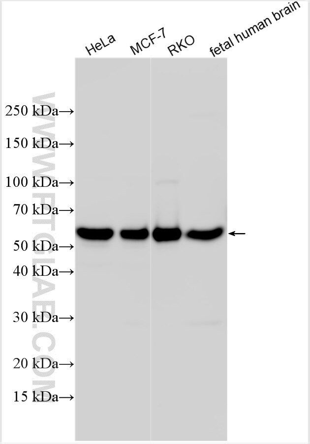 Western Blot (WB) analysis of various lysates using TXNDC15 Polyclonal antibody (32874-1-AP)