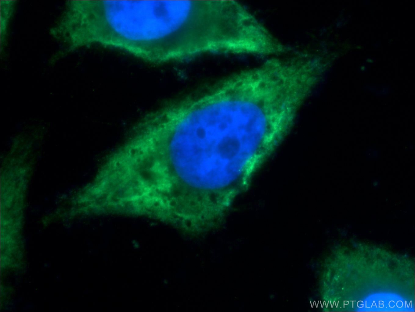 Immunofluorescence (IF) / fluorescent staining of HeLa cells using TXNDC16 Polyclonal antibody (21502-1-AP)