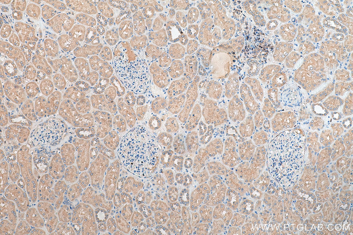 Immunohistochemistry (IHC) staining of human kidney tissue using TXNDC16 Polyclonal antibody (21502-1-AP)