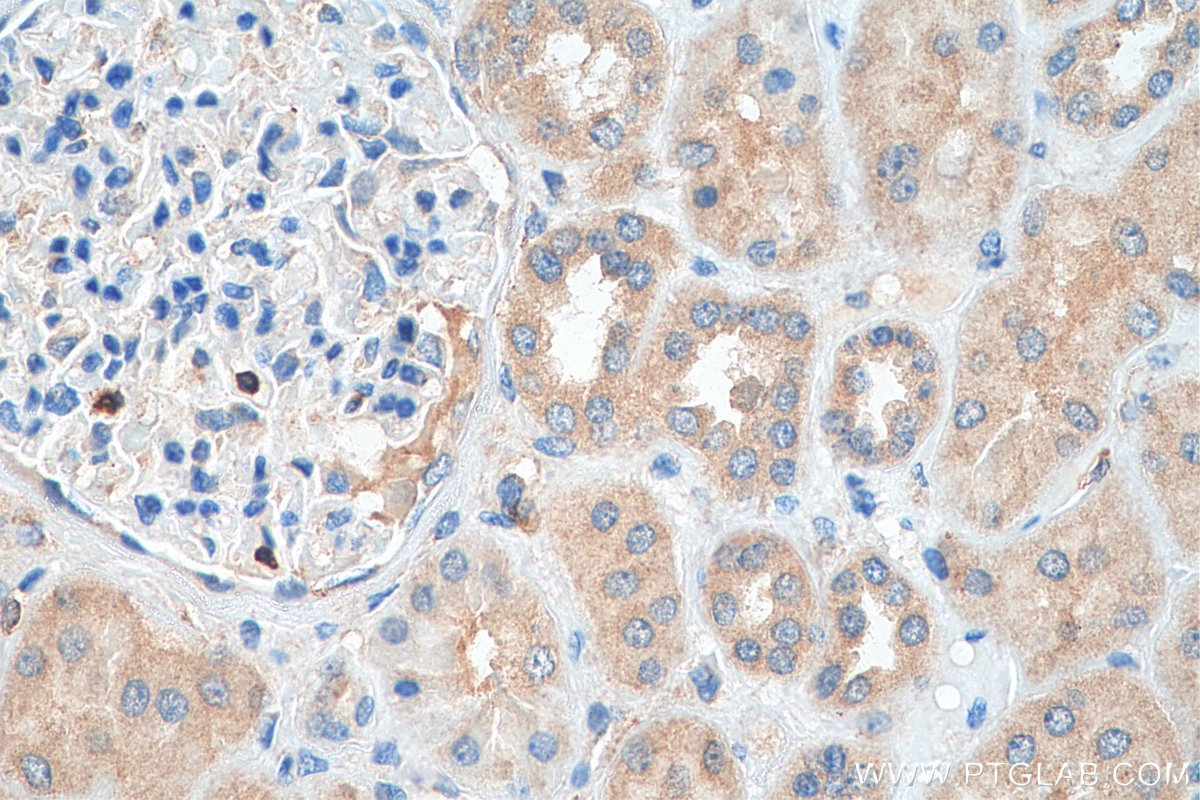 Immunohistochemistry (IHC) staining of human kidney tissue using TXNDC16 Polyclonal antibody (21502-1-AP)