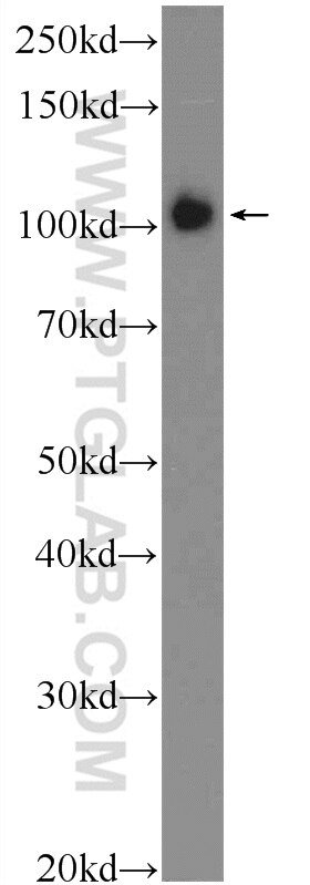 WB analysis of SMMC-7721 using 21502-1-AP