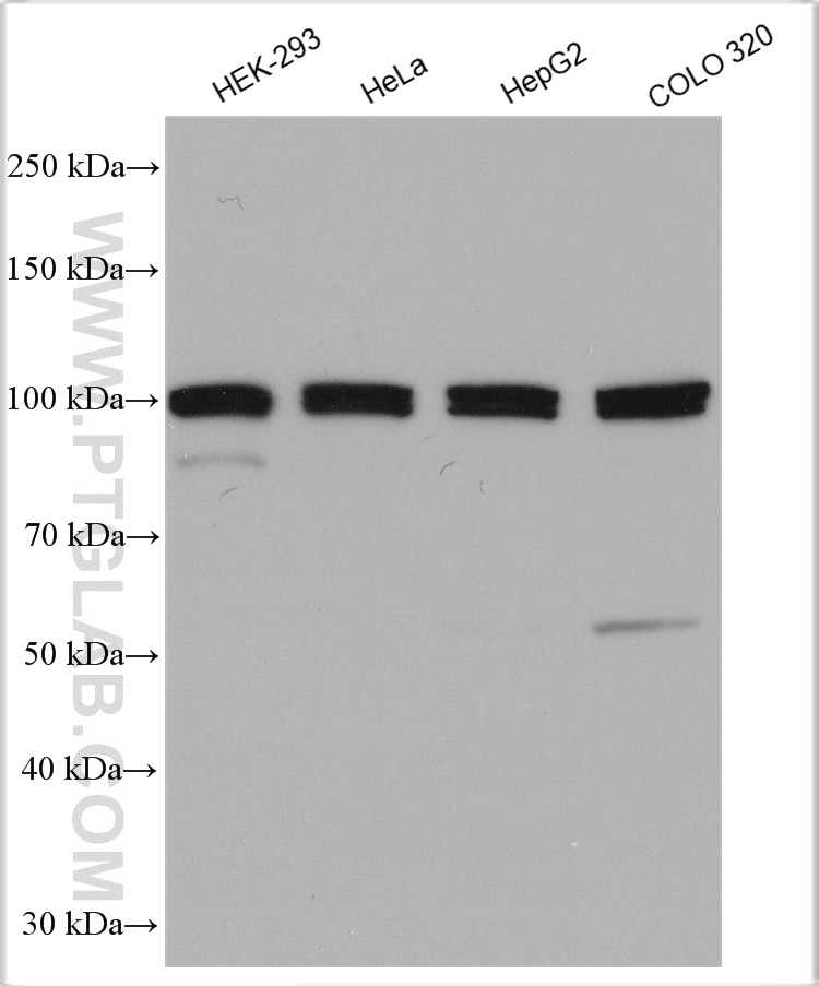 Western Blot (WB) analysis of various lysates using TXNDC16 Polyclonal antibody (21502-1-AP)
