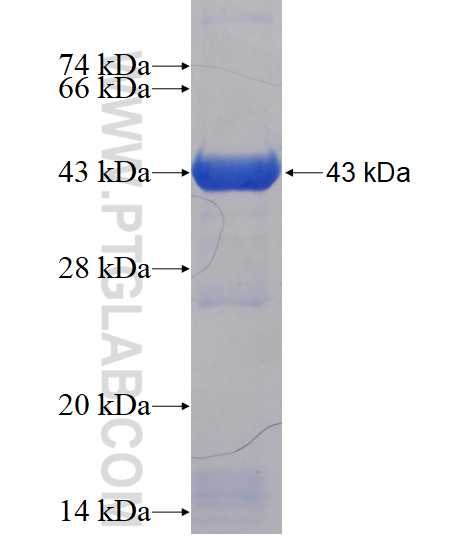 TXNDC16 fusion protein Ag15946 SDS-PAGE