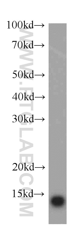 WB analysis of HEK-293 using 20811-1-AP