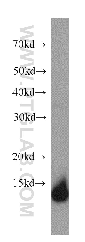 Western Blot (WB) analysis of HeLa cells using TXNDC17 Polyclonal antibody (20811-1-AP)