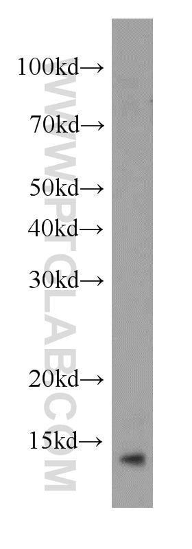 Western Blot (WB) analysis of human uterus tissue using TXNDC17 Polyclonal antibody (20811-1-AP)