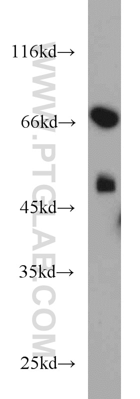 Western Blot (WB) analysis of human testis tissue using TXNDC3 Polyclonal antibody (13586-1-AP)