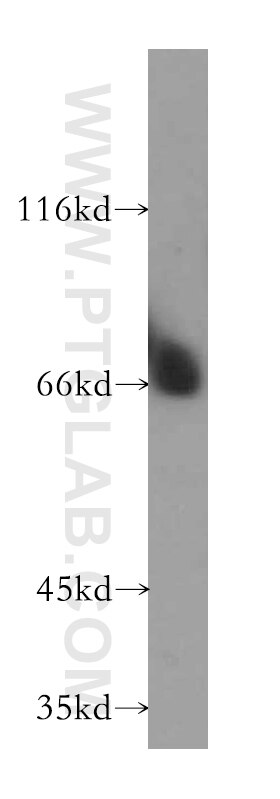 Western Blot (WB) analysis of mouse testis tissue using TXNDC3 Polyclonal antibody (13586-1-AP)