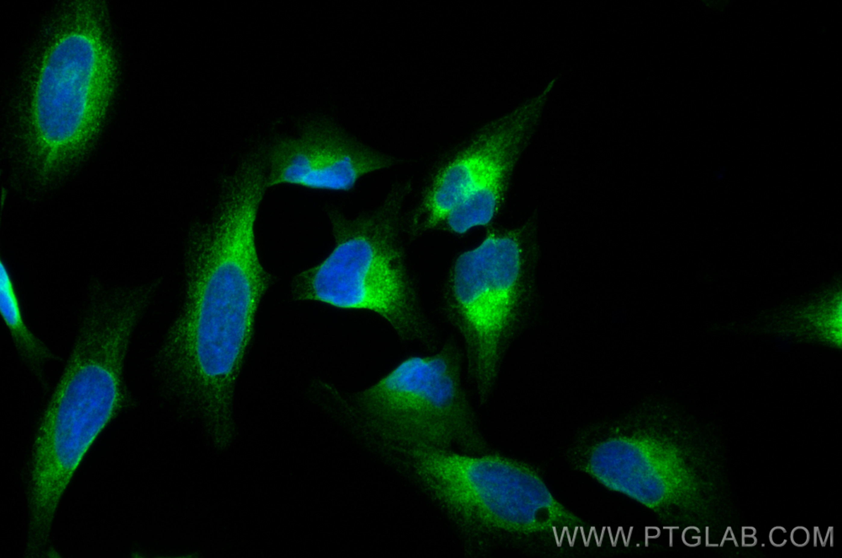 Immunofluorescence (IF) / fluorescent staining of HeLa cells using TXNDC5 Polyclonal antibody (19834-1-AP)