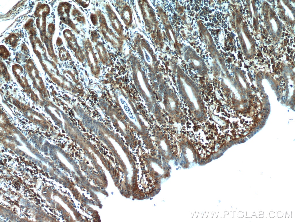 Immunohistochemistry (IHC) staining of human stomach tissue using TXNDC5 Polyclonal antibody (19834-1-AP)
