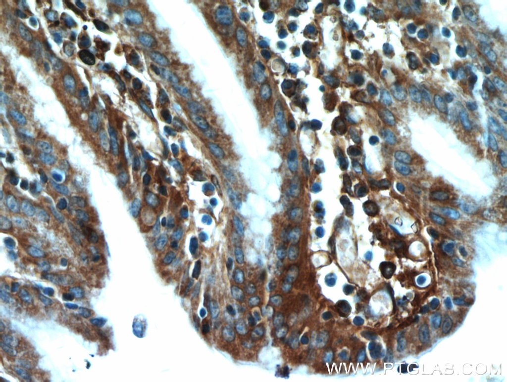 Immunohistochemistry (IHC) staining of human stomach tissue using TXNDC5 Polyclonal antibody (19834-1-AP)