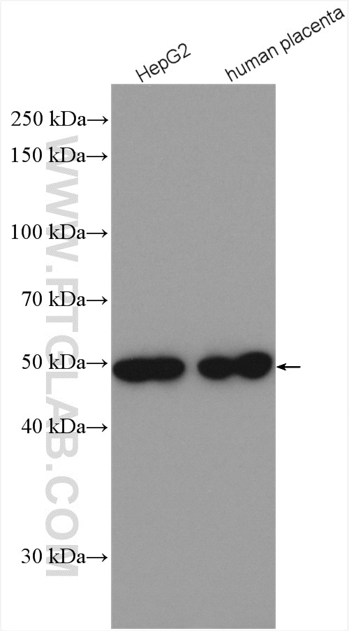 Western Blot (WB) analysis of various lysates using TXNDC5 Polyclonal antibody (19834-1-AP)