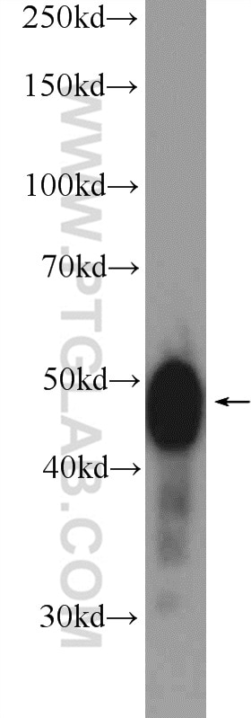 Western Blot (WB) analysis of mouse colon tissue using TXNDC5 Polyclonal antibody (19834-1-AP)