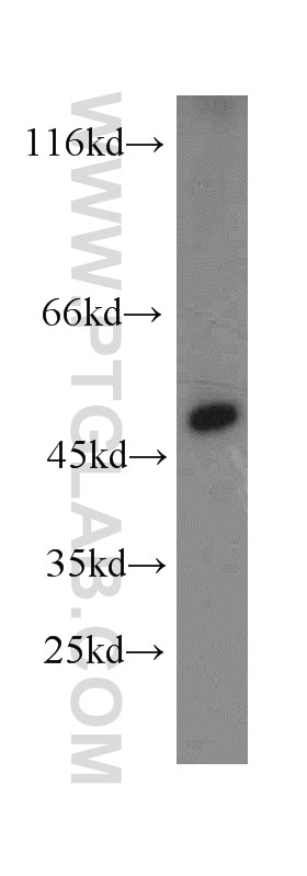 Western Blot (WB) analysis of human skeletal muscle tissue using TXNDC5 Polyclonal antibody (19834-1-AP)