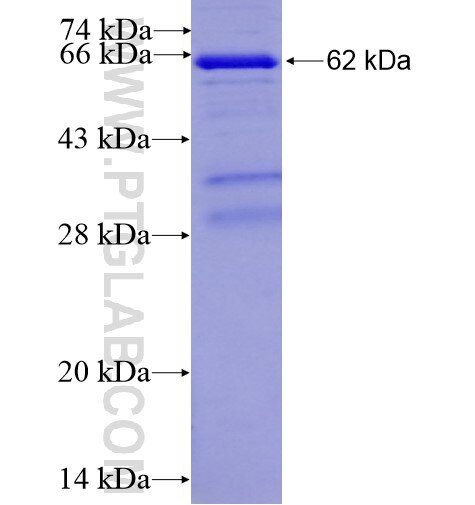 TXNDC5 fusion protein Ag13808 SDS-PAGE
