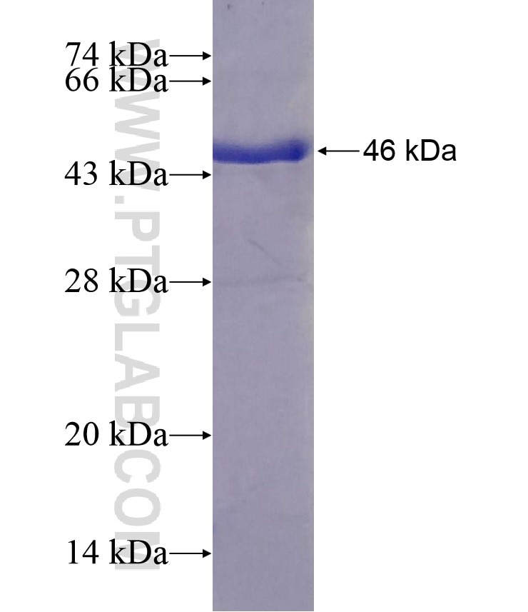 TXNDC5 fusion protein Ag13965 SDS-PAGE