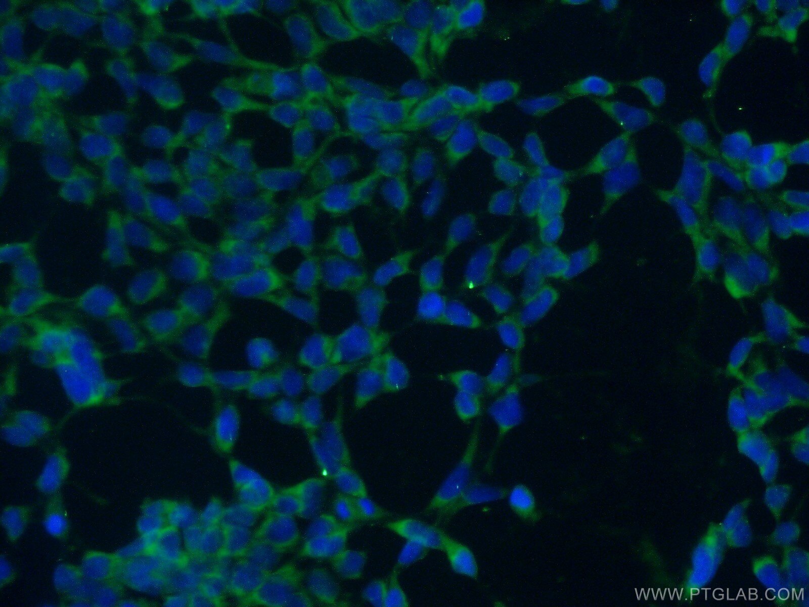 Immunofluorescence (IF) / fluorescent staining of HEK-293 cells using TXNDC9 Polyclonal antibody (25208-1-AP)